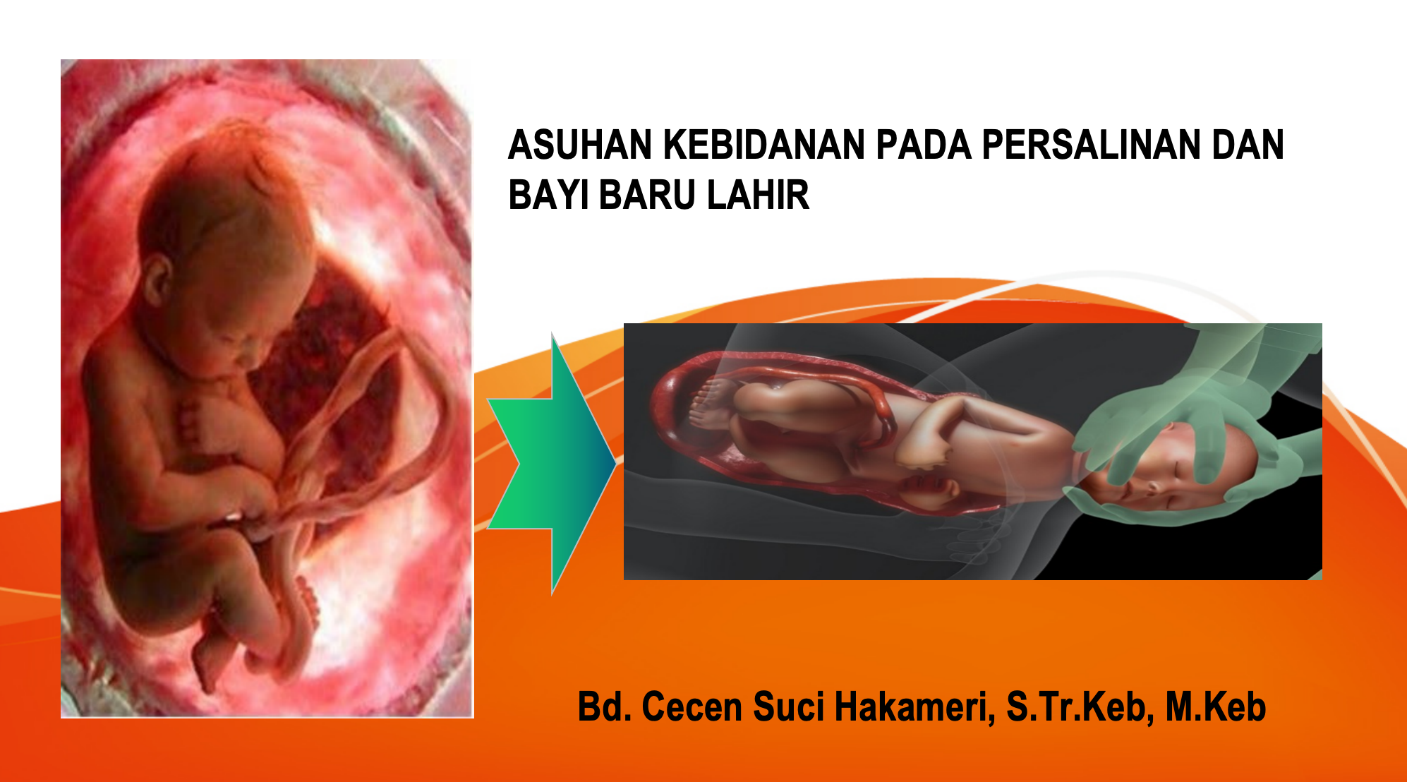 ASUHAN KEBIDANAN PADA PERSALINAN DAN BBL 