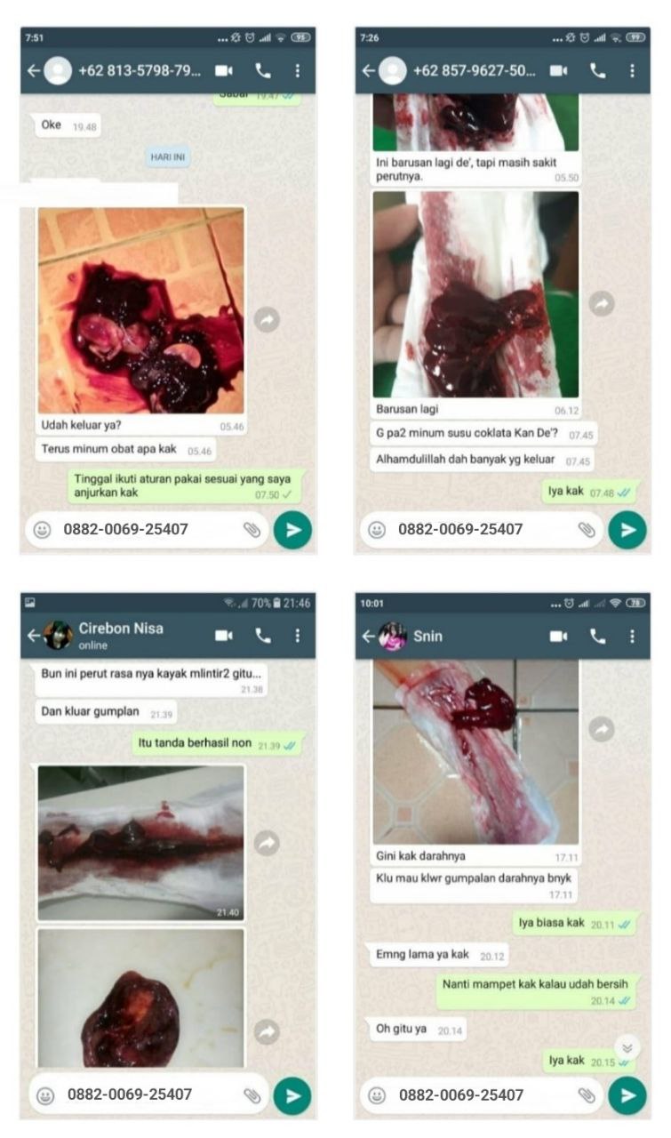 0882006925407 Obat Aborsi Penggugur Kandungan Ampuh Terpercaya